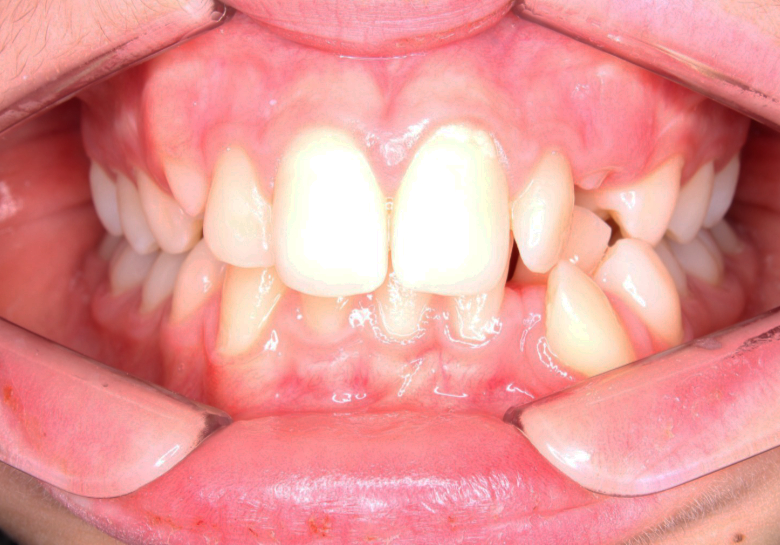 ortodonzia-prima